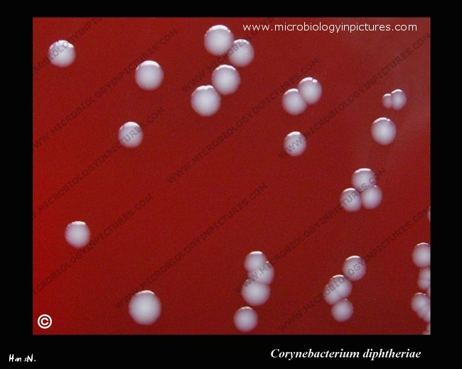 corynebacterium diphtheriae colonies on blood agar